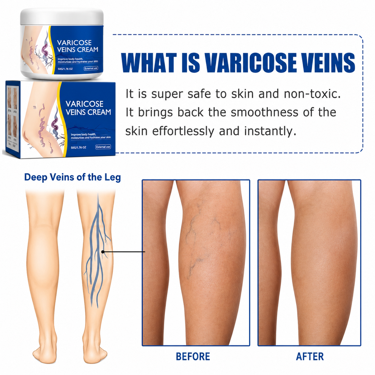 Varicose Vein Relief Cream for Heavy & Tired Legs
