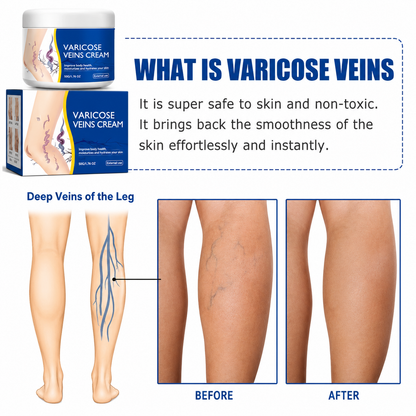 Varicose Vein Relief Cream for Heavy & Tired Legs
