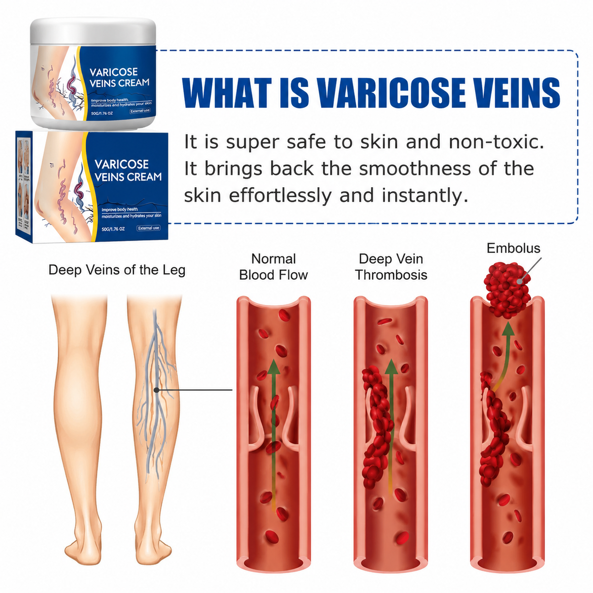 Varicose Vein Relief Cream for Heavy & Tired Legs