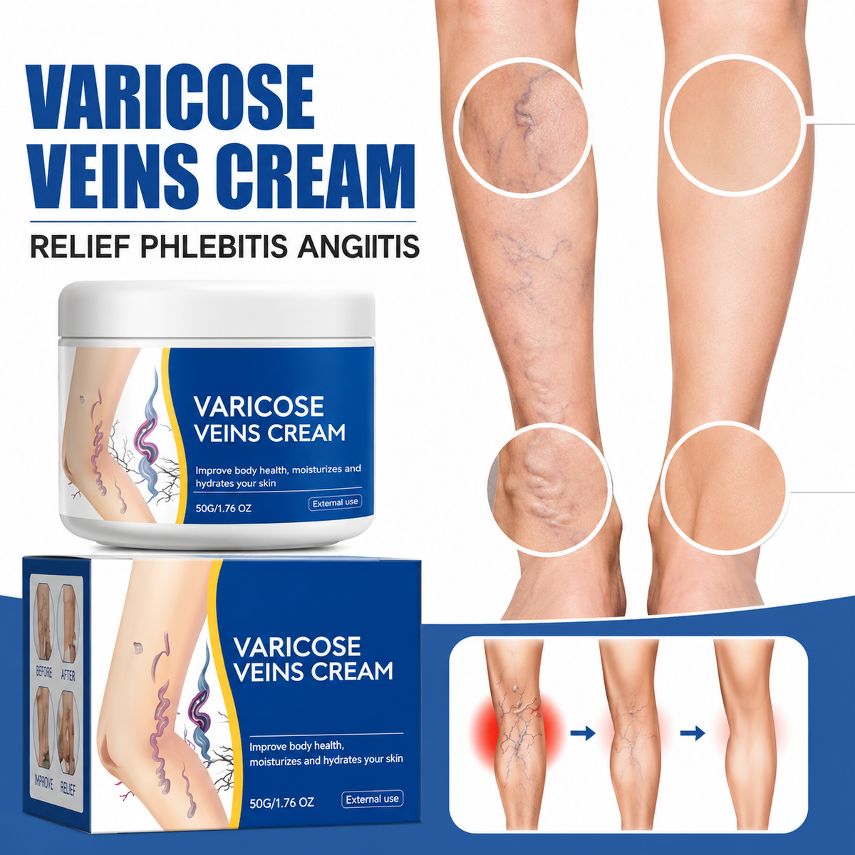 Varicose Vein Relief Cream for Heavy & Tired Legs