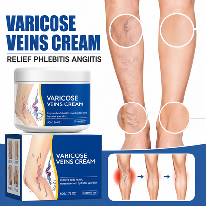 Varicose Vein Relief Cream for Heavy & Tired Legs